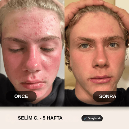 Herbfy Arındırıcı Yüz Temizleme Jeli – 150 ml